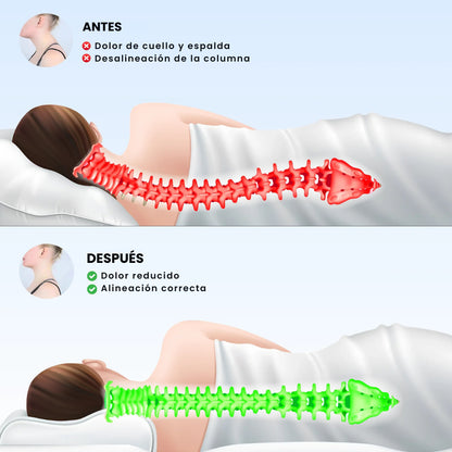CerviFlex